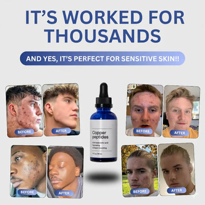 Dermapulse™ Copper Peptides