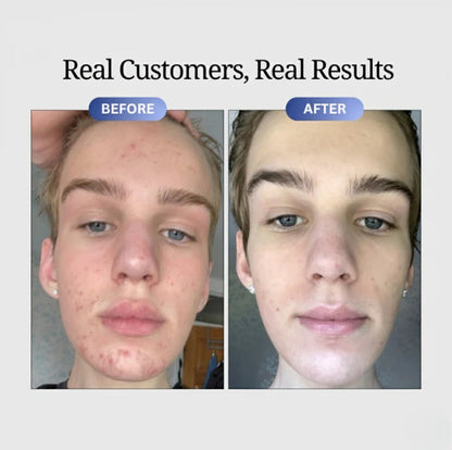 Dermapulse™ Copper Peptides