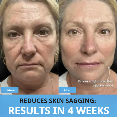 Dermapulse™ V-Sculpt Pro