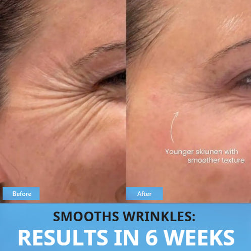 Dermapulse™ V-Sculpt Pro