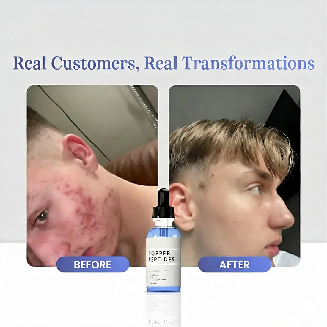 Dermapulse™ Copper Peptides